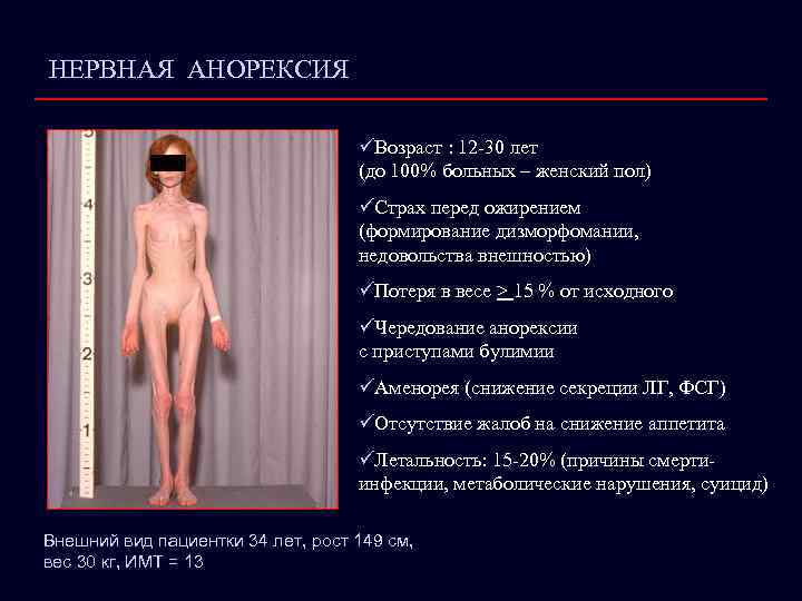 НЕРВНАЯ АНОРЕКСИЯ üВозраст : 12 -30 лет (до 100% больных – женский пол) üСтрах