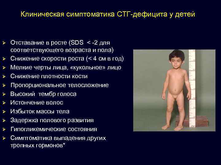 Клиническая симптоматика СТГ-дефицита у детей Ø Ø Ø Отставание в росте (SDS < -2