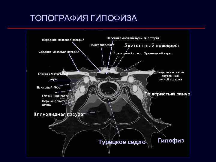 ТОПОГРАФИЯ ГИПОФИЗА Передняя мозговая артерия Передняя соединительная артерия Ножка гипофиза Средняя мозговая артерия Зрительный