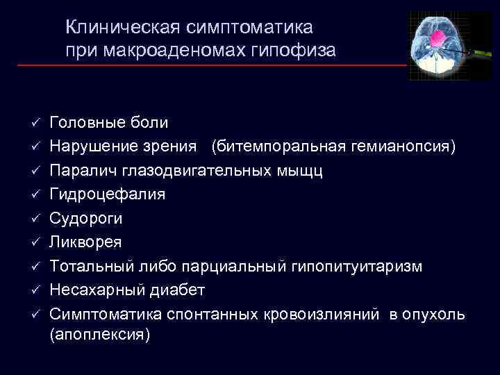 Клиническая симптоматика при макроаденомах гипофиза ü ü ü ü ü Головные боли Нарушение зрения