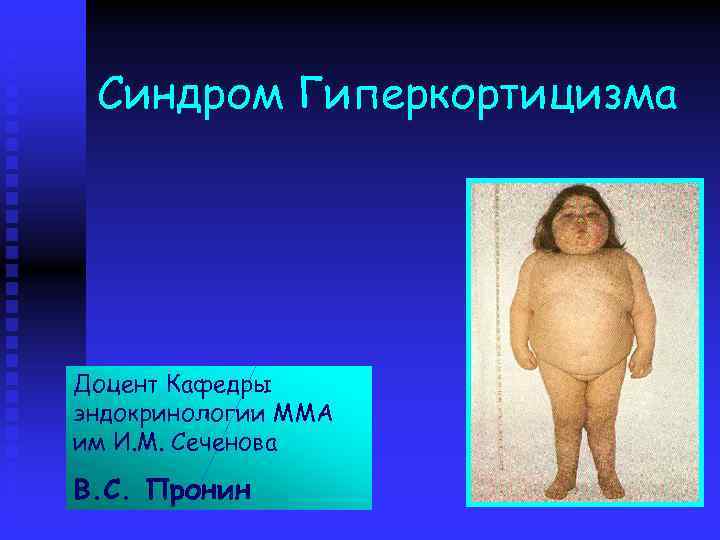 Синдром Гиперкортицизма Доцент Кафедры эндокринологии ММА им И. М. Сеченова В. С. Пронин 