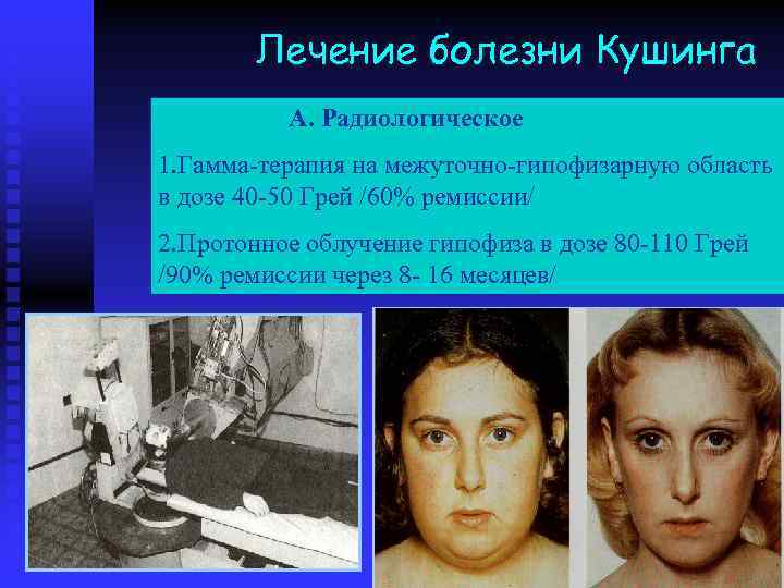 Лечение болезни Кушинга А. Радиологическое 1. Гамма-терапия на межуточно-гипофизарную область в дозе 40 -50