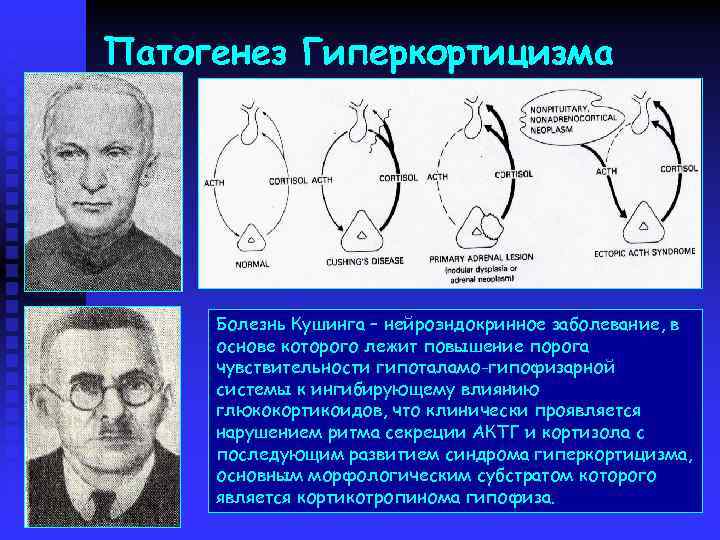 Патогенез Гиперкортицизма Болезнь Кушинга – нейроэндокринное заболевание, в основе которого лежит повышение порога чувствительности