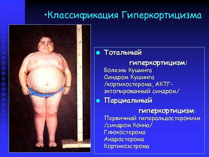  • Классификация Гиперкортицизма n Тотальный гиперкортицизм: Болезнь Кушинга Синдром Кушинга /кортикостерома, АКТГэктопированный синдром/