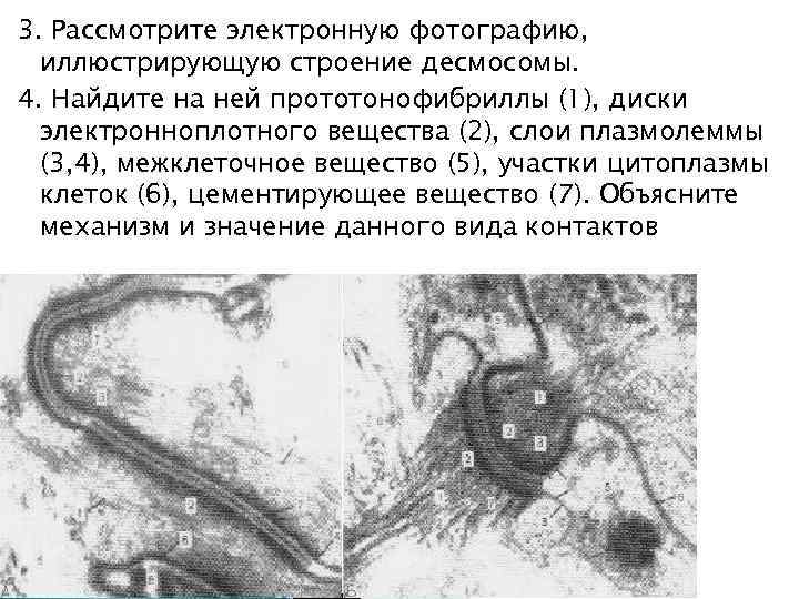 3. Рассмотрите электронную фотографию, иллюстрирующую строение десмосомы. 4. Найдите на ней прототонофибриллы (1), диски