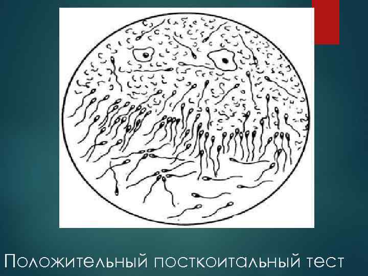 Положительный посткоитальный тест 