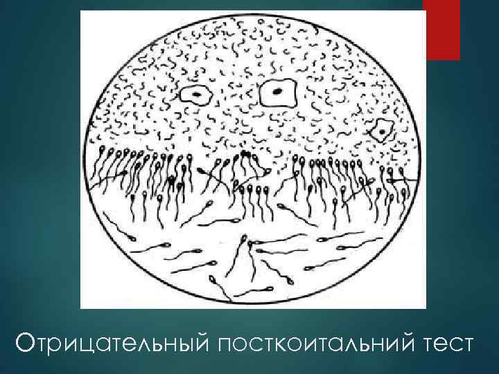 Отрицательный посткоитальний тест 