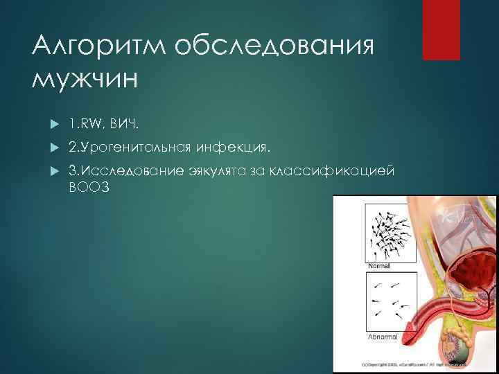 Алгоритм обследования мужчин 1. RW, ВИЧ. 2. Урогенитальная инфекция. 3. Исследование эякулята за классификацией
