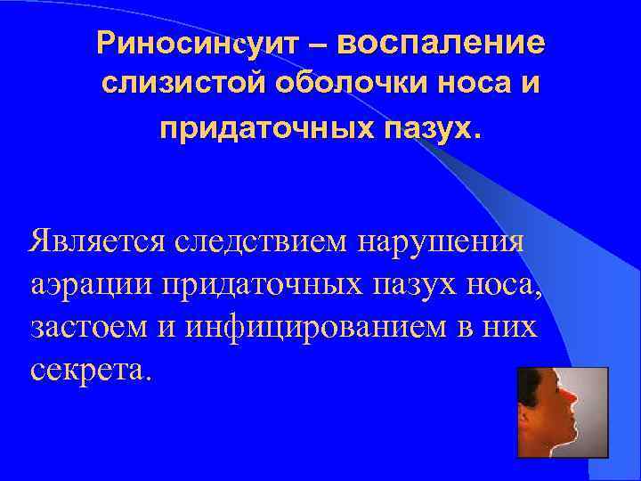 Риносинсуит – воспаление слизистой оболочки носа и придаточных пазух. Является следствием нарушения аэрации придаточных