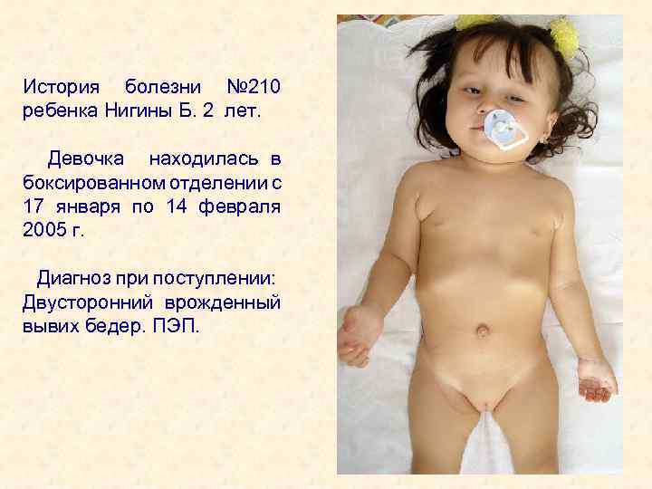 История болезни № 210 ребенка Нигины Б. 2 лет. Девочка находилась в боксированном отделении
