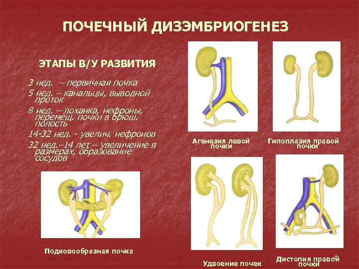 ПОЧЕЧНЫЙ ДИЗЭМБРИОГЕНЕЗ ЭТАПЫ В/У РАЗВИТИЯ 3 нед. – первичная почка 5 нед. – канальцы,