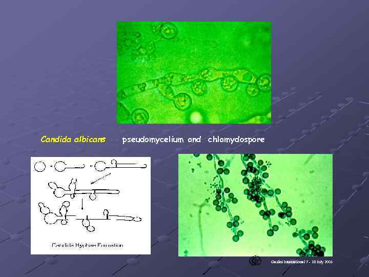 Candida albicans -- pseudomycelium and chlamydospore Gaslini International 7 - 18 July 2003 