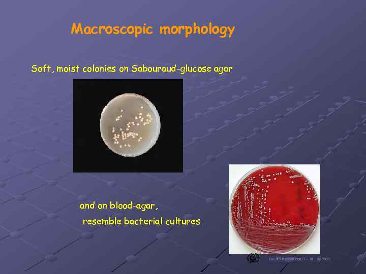 Macroscopic morphology Soft, moist colonies on Sabouraud-glucose agar and on blood-agar, resemble bacterial cultures