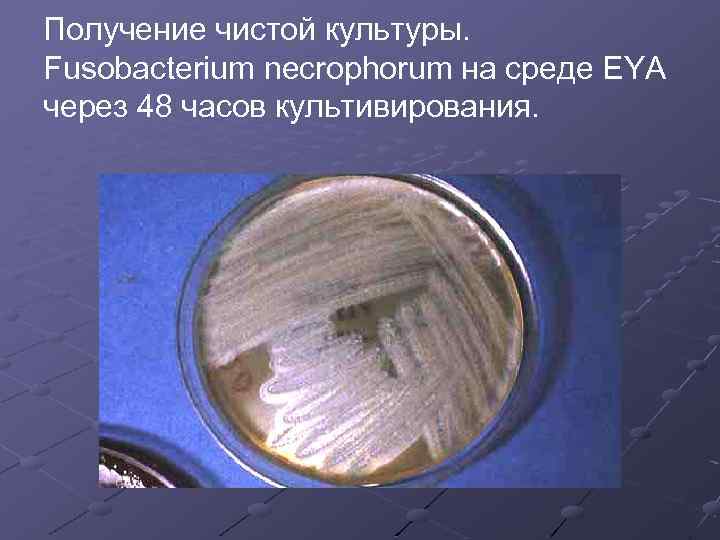 Получение чистой культуры. Fusobacterium necrophorum на среде EYA через 48 часов культивирования. 