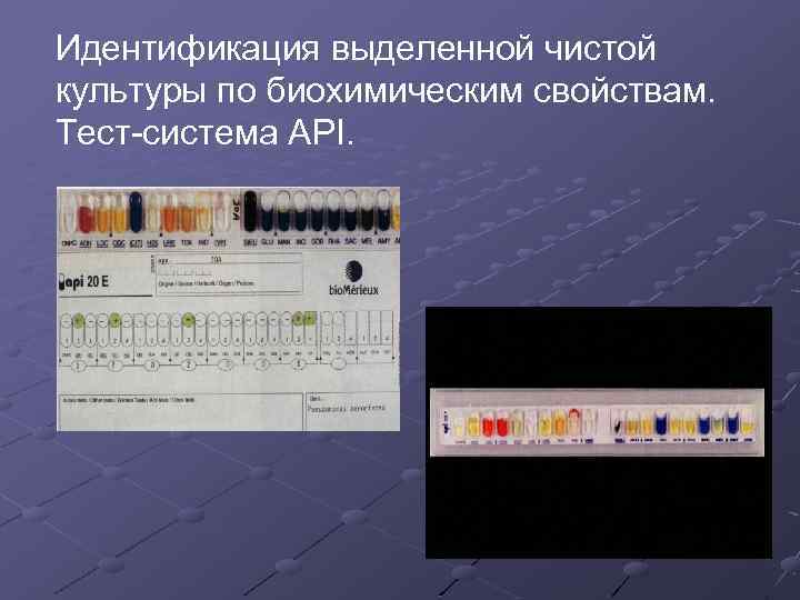 Идентификация выделенной чистой культуры по биохимическим свойствам. Тест-система API. 