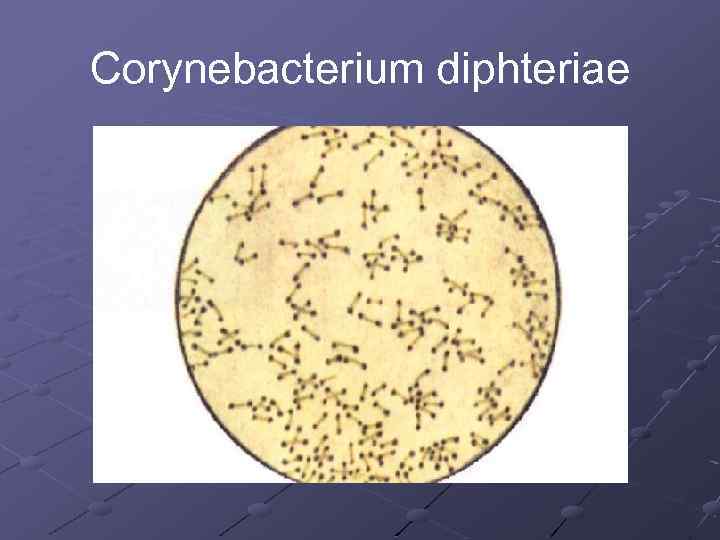 Corynebacterium diphteriae 