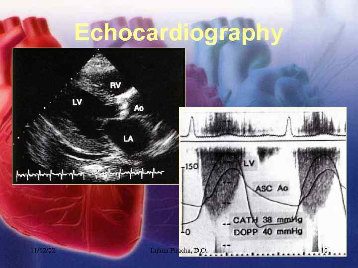 Echocardiography 11/12/02 Lubna Piracha, D. O. 10 