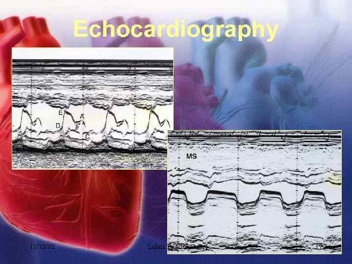 Echocardiography 11/12/02 Lubna Piracha, D. O. 17 