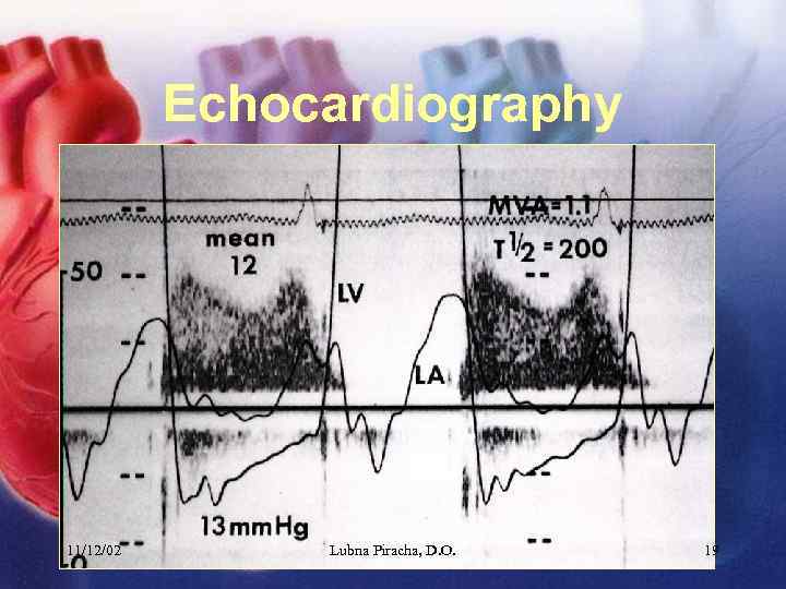Echocardiography 11/12/02 Lubna Piracha, D. O. 19 