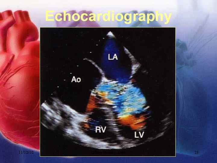 Echocardiography 11/12/02 Lubna Piracha, D. O. 23 