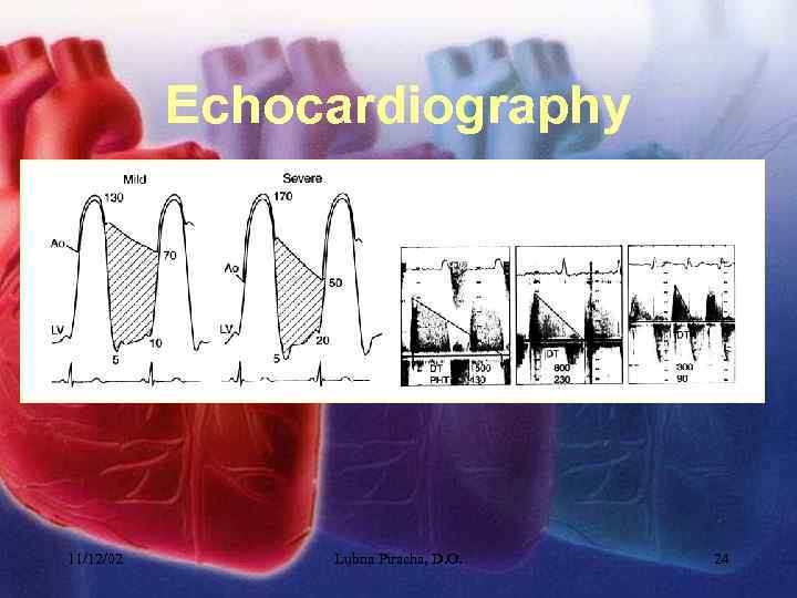 Echocardiography 11/12/02 Lubna Piracha, D. O. 24 