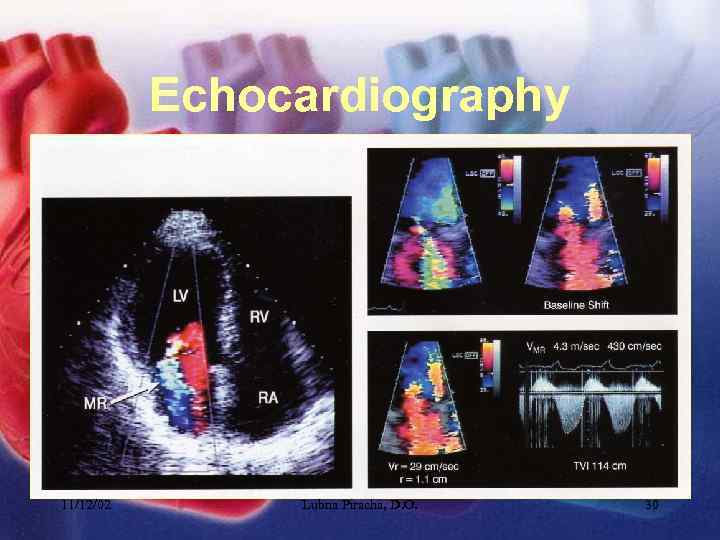 Echocardiography 11/12/02 Lubna Piracha, D. O. 30 