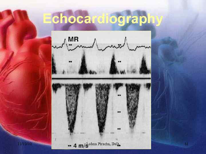 Echocardiography 11/12/02 Lubna Piracha, D. O. 31 