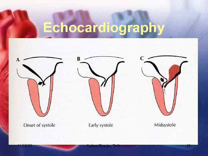 Echocardiography 11/12/02 Lubna Piracha, D. O. 37 