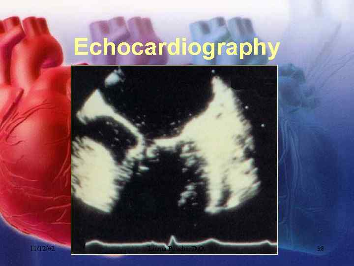 Echocardiography 11/12/02 Lubna Piracha, D. O. 38 