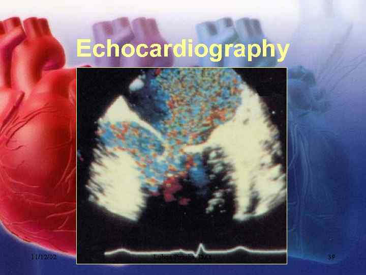 Echocardiography 11/12/02 Lubna Piracha, D. O. 39 