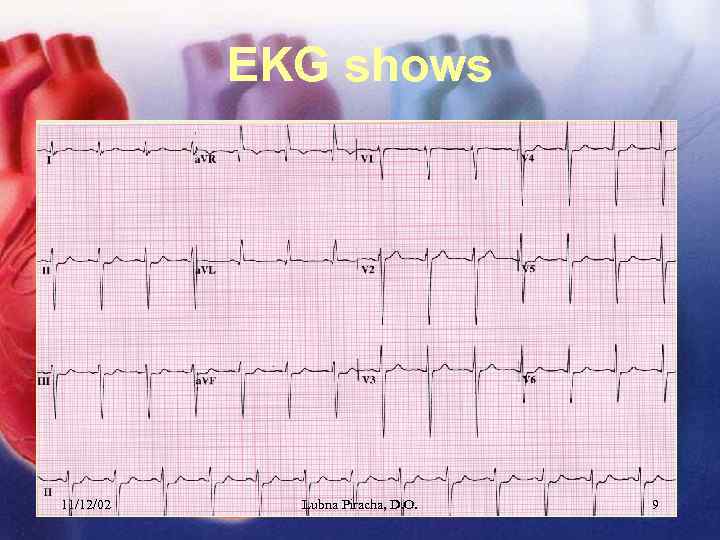 EKG shows 11/12/02 Lubna Piracha, D. O. 9 