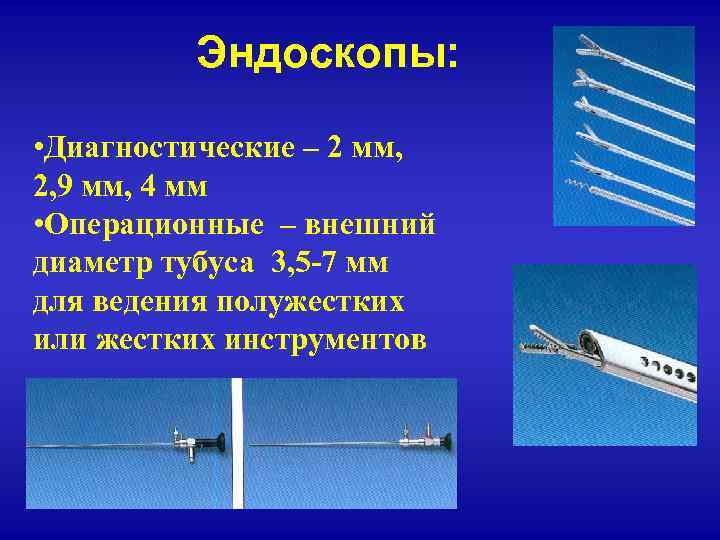 Эндоскопы: • Диагностические – 2 мм, 2, 9 мм, 4 мм • Операционные –