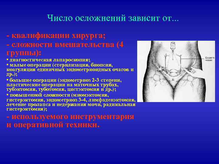 Число осложнений зависит от. . . - квалификации хирурга; - сложности вмешательства (4 группы):