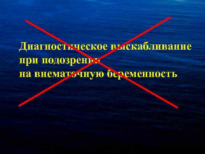 Диагностическое выскабливание при подозрении на внематочную беременность 