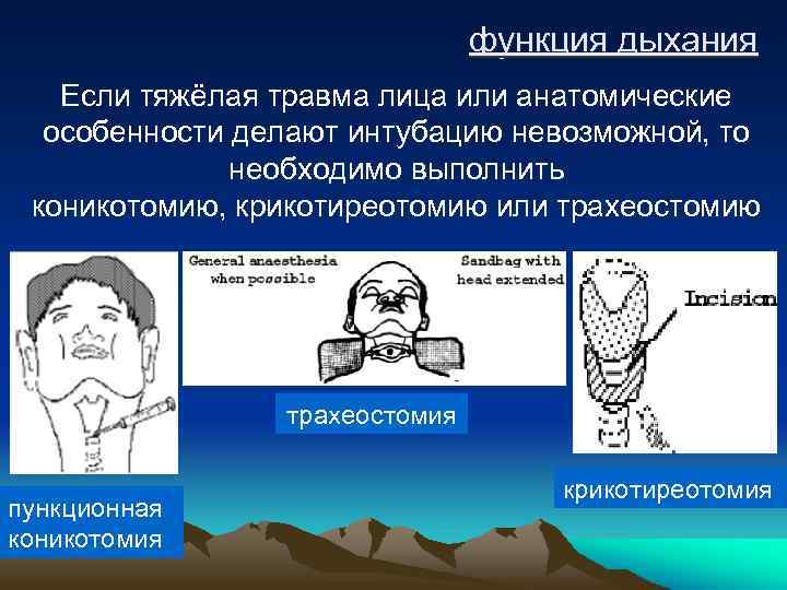 функция дыхания Если тяжёлая травма лица или анатомические особенности делают интубацию невозможной, то необходимо