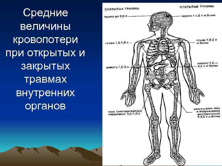 Средние величины кровопотери при открытых и закрытых травмах внутренних органов 