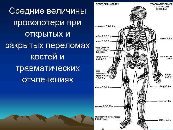 Средние величины кровопотери при открытых и закрытых переломах костей и травматических отчленениях 