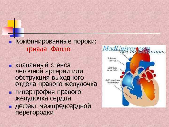 n n Комбинированные пороки: триада Фалло клапанный стеноз лёгочной артерии или обструкция выходного отдела