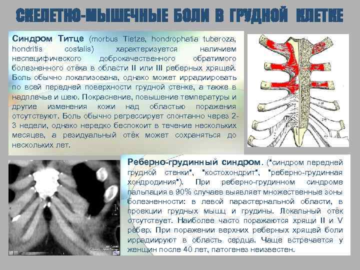 Кости могут болеть