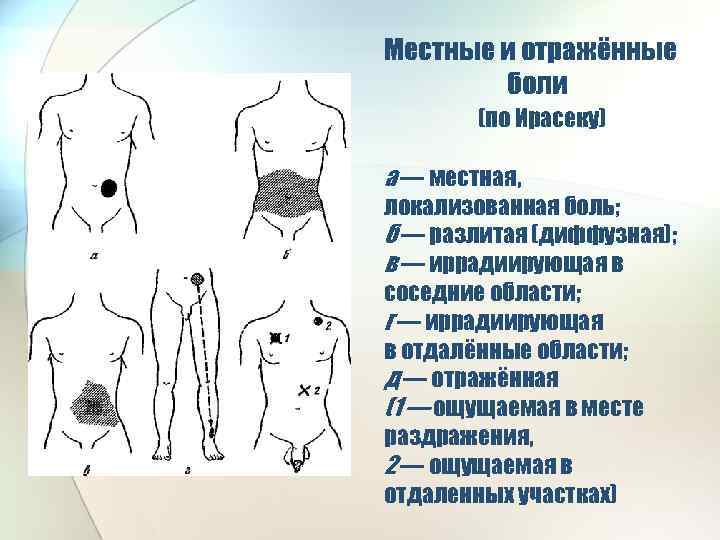 Местные и отражённые боли (по Ирасеку) а — местная, локализованная боль; б — разлитая