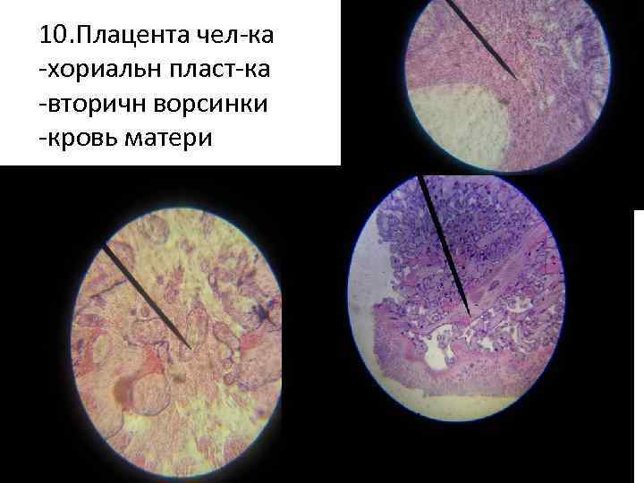 10. Плацента чел-ка -хориальн пласт-ка -вторичн ворсинки -кровь матери 