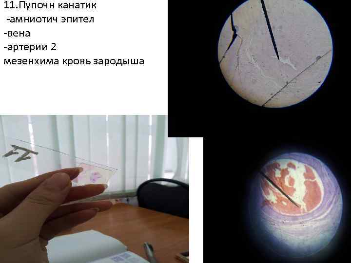 11. Пупочн канатик -амниотич эпител -вена -артерии 2 мезенхима кровь зародыша 