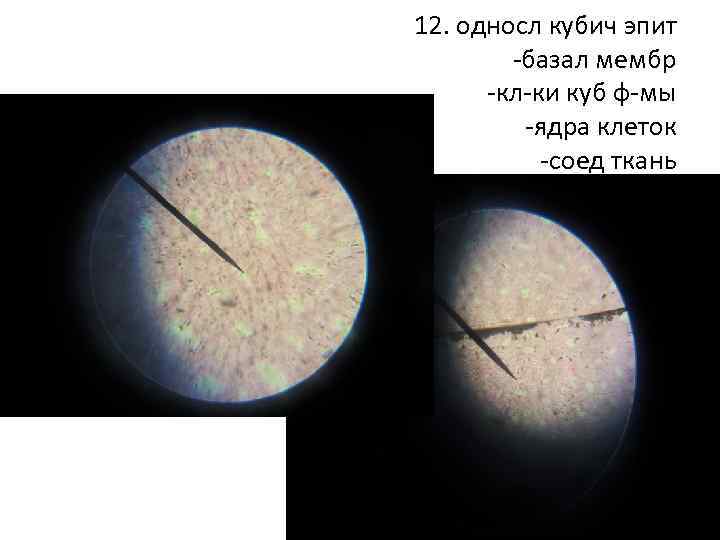 12. односл кубич эпит -базал мембр -кл-ки куб ф-мы -ядра клеток -соед ткань 
