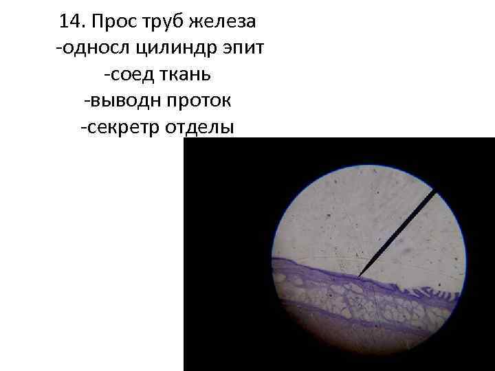 14. Прос труб железа -односл цилиндр эпит -соед ткань -выводн проток -секретр отделы 