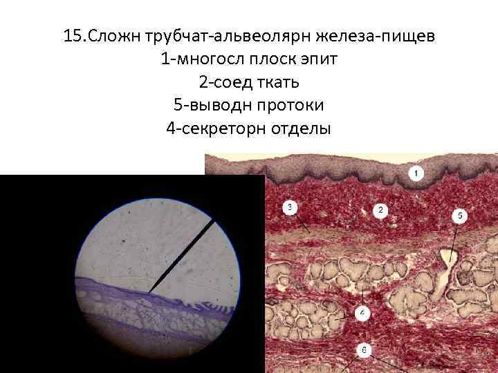 15. Сложн трубчат-альвеолярн железа-пищев 1 -многосл плоск эпит 2 -соед ткать 5 -выводн протоки