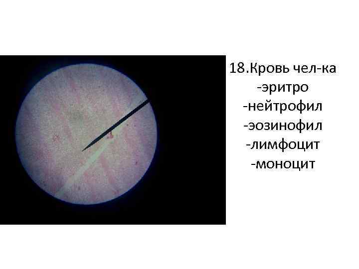 18. Кровь чел-ка -эритро -нейтрофил -эозинофил -лимфоцит -моноцит 