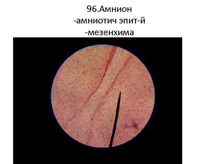 96. Амнион -амниотич эпит-й -мезенхима 