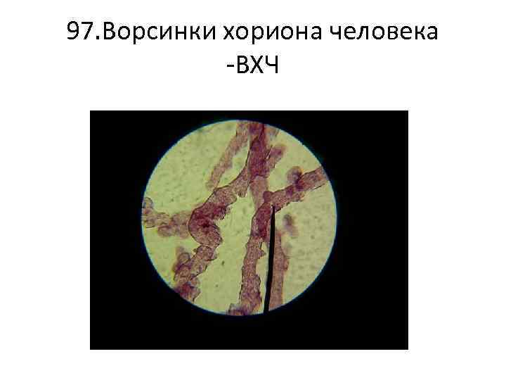97. Ворсинки хориона человека -ВХЧ 