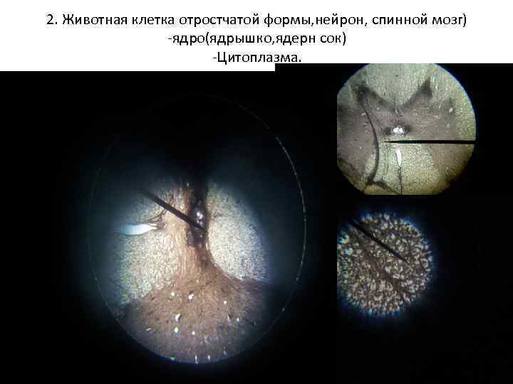2. Животная клетка отростчатой формы, нейрон, спинной мозг) -ядро(ядрышко, ядерн сок) -Цитоплазма. 