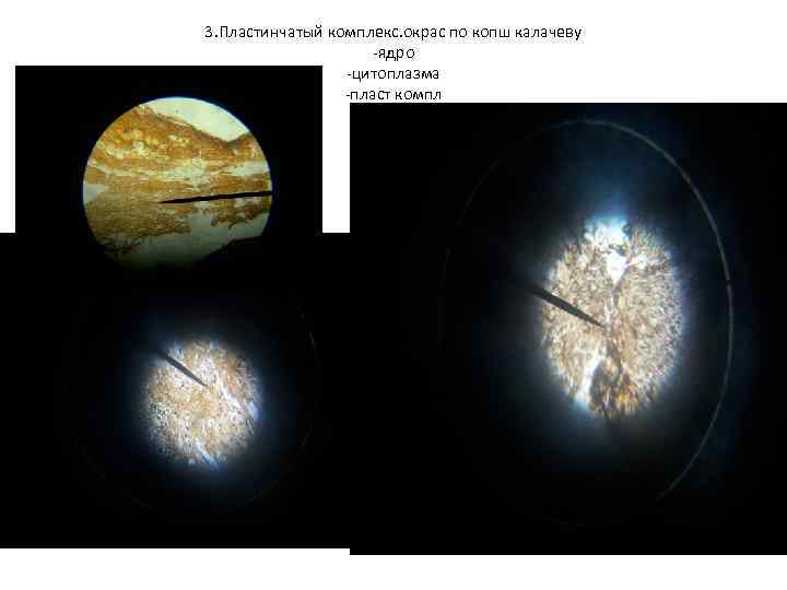 3. Пластинчатый комплекс. окрас по копш калачеву -ядро -цитоплазма -пласт компл 